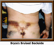 Bryce's Backside